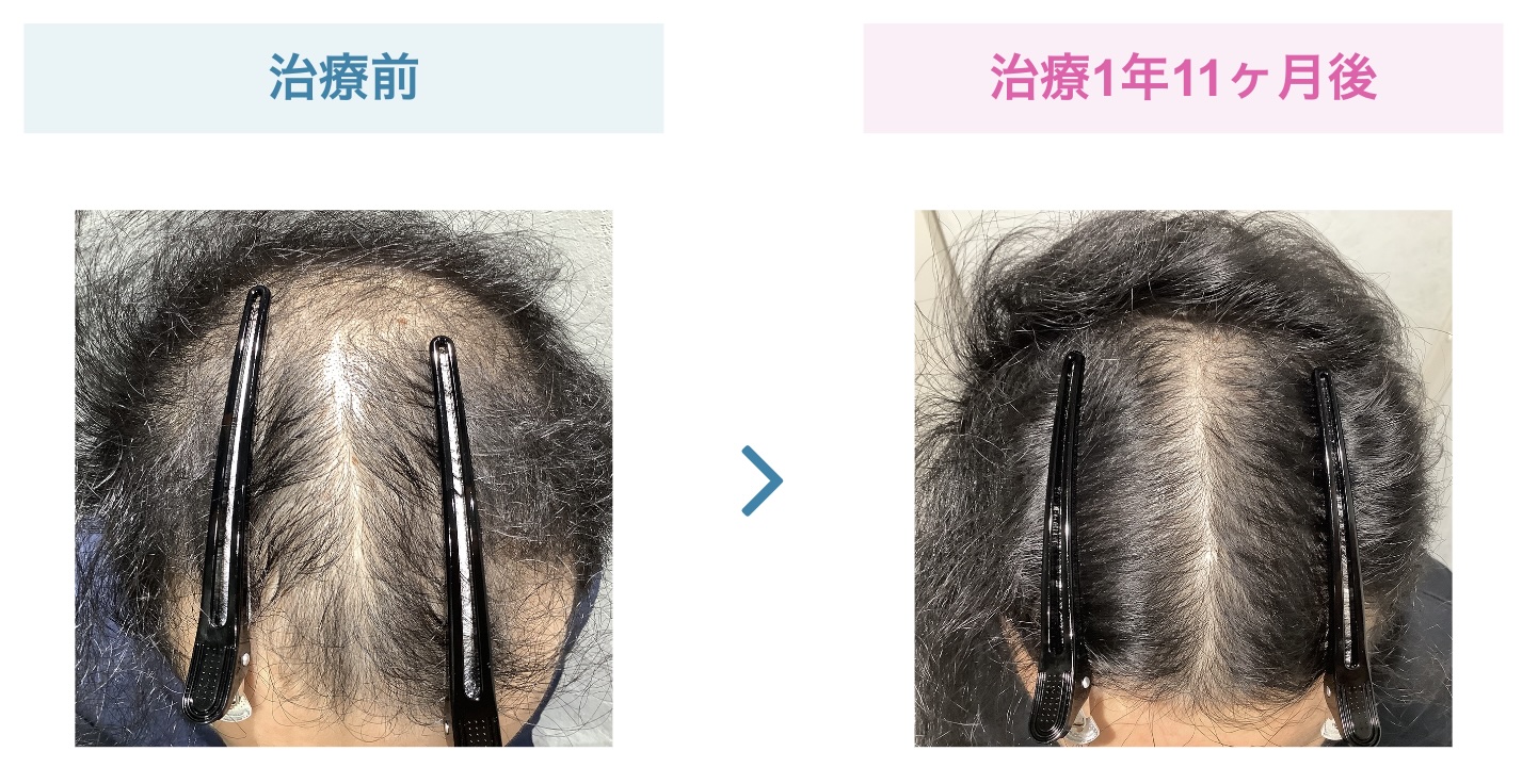 will事例
